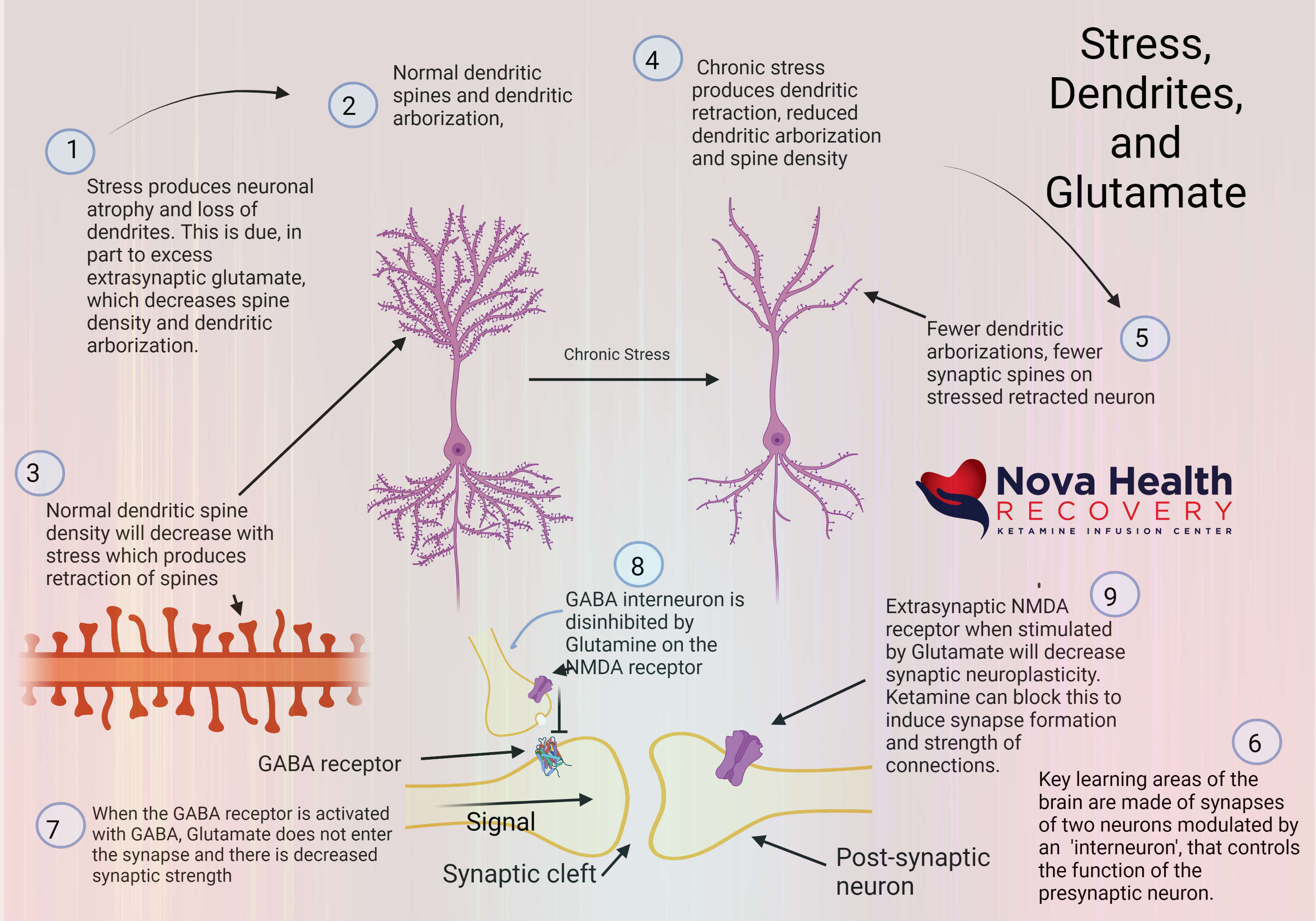 Stress -neurons-dendrites and how ketamine can help